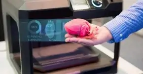 L’impression 3D médicale : Une révolution sur mesure pour l’autonomie